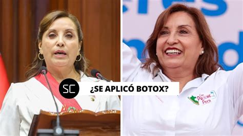 Dina Boluarte Se Oper La Nariz Y Se Aplic Botox En El Rostro