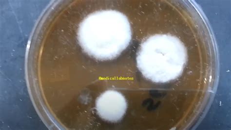 Sabouraud Dextrose Agar Sda Introduction Principle Composit