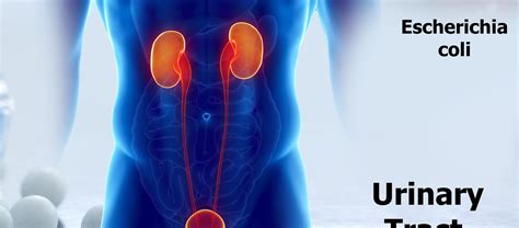 Urinary Tract Infection Treatment Market Fmi