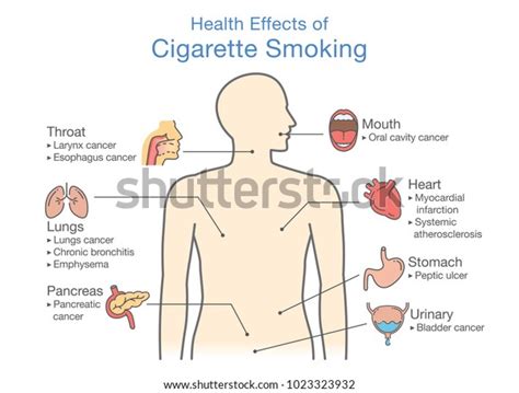 Diagram About Health Effect Cigarette Smoking Stock Vector (Royalty ...