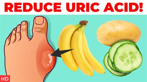 Top 8 Foods That Reduce Uric Acid Levels Naturally Youtube