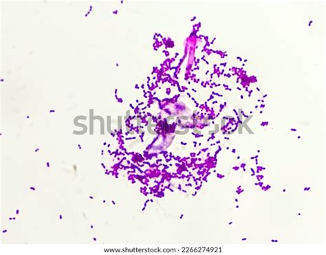 Gram Positive Cocci Bacteria Gram Staining Stock Photo 2266274921 | Shutterstock