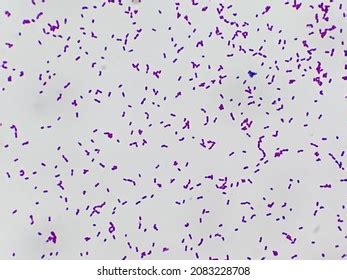 Enterococcus Gram Stain