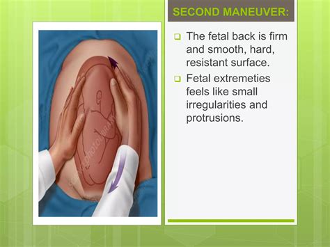 Leopold’s Maneuver Ppt