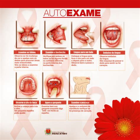 SaÚde Maio Vermelho Campanha De Conscientização Do Câncer Bucal