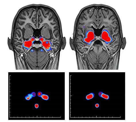 HOW PORN IS REWIRING OUR BRAINS THE NEUROLOGICAL IMPACT OF DIGITAL SEXUAL CONTENT