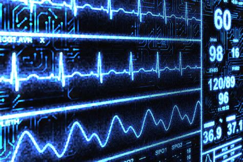 Cardiac Arrhythmia Management Irregular Heartbeat Capital Area