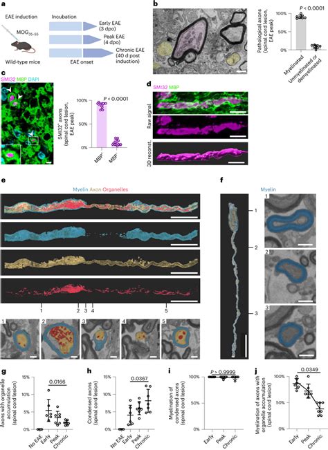 The Dynamics Of Axonal Pathology In Eae A Experimental Outline Eae