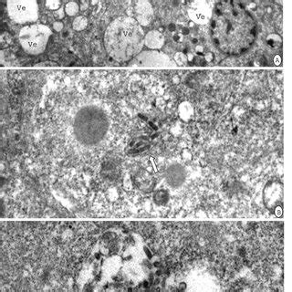 Cytopathogenic Effects Cpe Produced By The Original Viral Isolate In