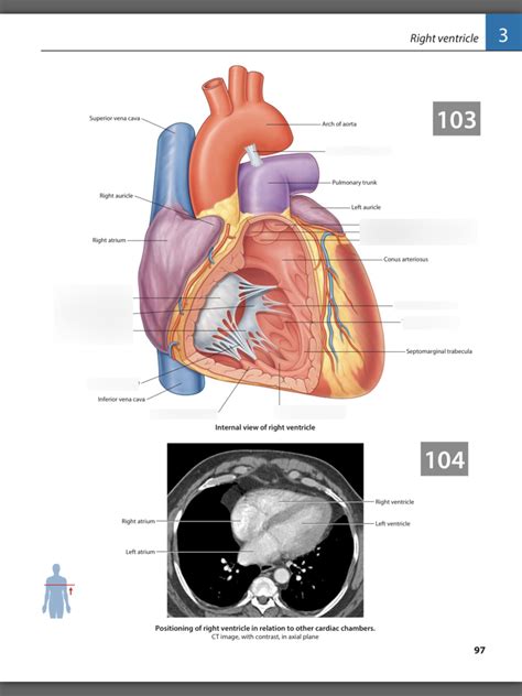 Right Ventricle Diagram Quizlet