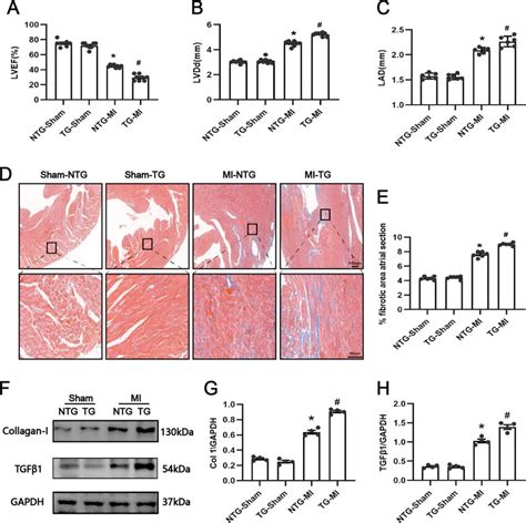 Effect Of USP38 Cardiac Specific Overexpression On Atrial Fibrosis