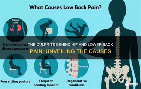 The Culprits Behind Hip And Lower Back Pain: Unveiling The Causes | MedShun