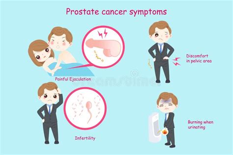 Prostate Cancer Symptoms Stock Illustrations 151 Prostate Cancer