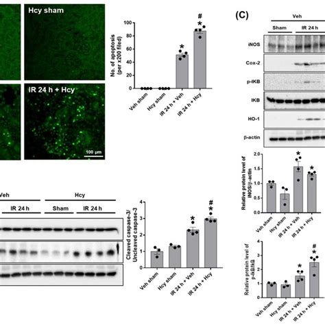 Hcy Exacerbates Renal Ir Induced Tubular Apoptosis In The Kidney The