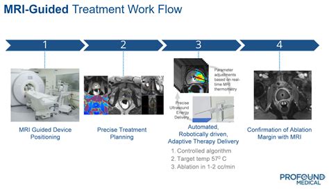 Profound Medical Innovation Offers 100 Upside Otcmktsprfmf Defunct