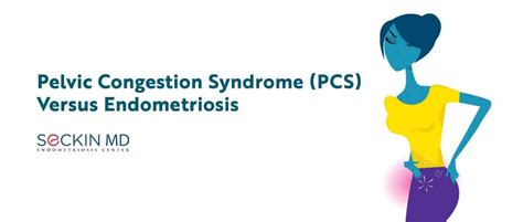 Pelvic Congestion Syndrome PCS Versus Endometriosis