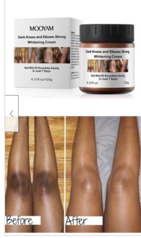 Mooyam Dark Knees And Elbows Lightening Cream G Skin Glow Haven