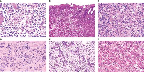 Frontiers Early Onset Development And Histological Features Of