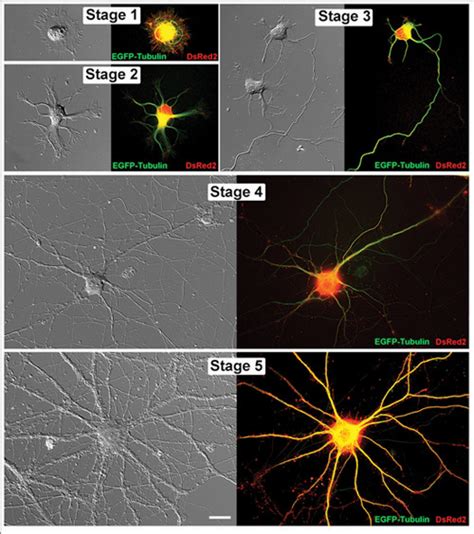 Living Hippocampal Neurons In Successive Stages Of Development Paired