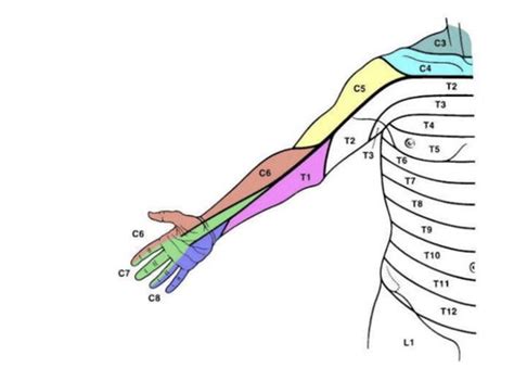 Cervical Radiculopathy And Myelopathy Flashcards Quizlet