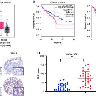 Overexpression Of Adamts Promotes The Proliferation And Migration Of