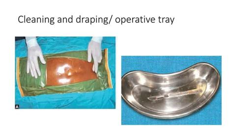 Laparotomy Opening And Closing