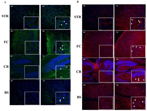 Immunostaining Of α Syn And P Tau In Wt And Tg Mice Download