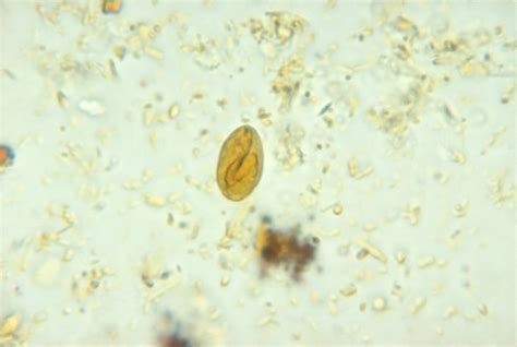 Giardia Duodenalis Cyst