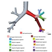 Lingula (lung) | Radiology Reference Article | Radiopaedia.org