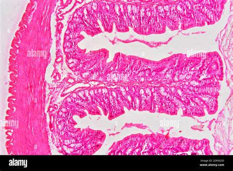 Recto Intestino Grueso Que Muestra Adventicia Capa Muscular Lámina