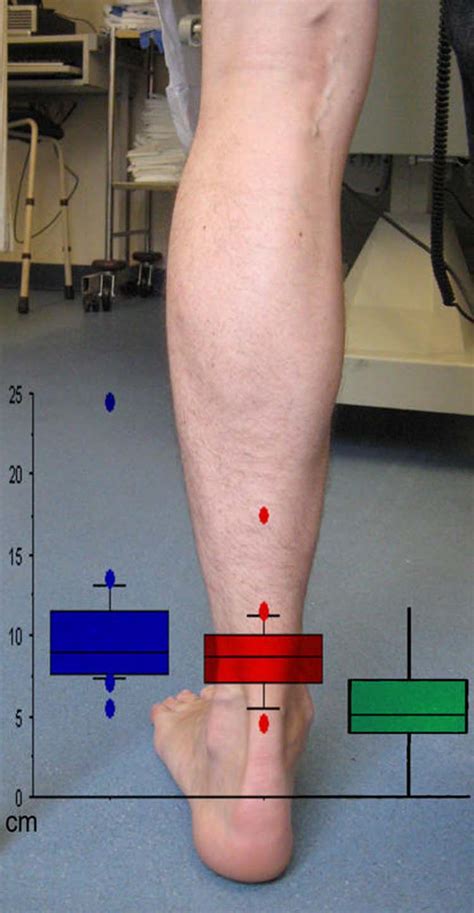 The Achilles Musculotendinous Junction A Survey Of Orthopaedic Surgeons The Foot And Ankle