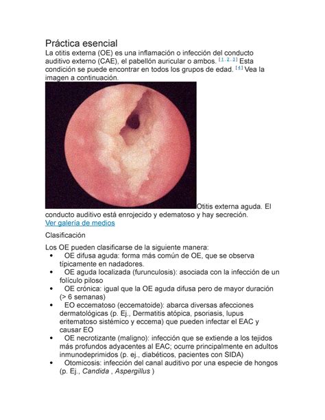 Otitis Externa Aguda Difusa Ecured The Best Porn Website