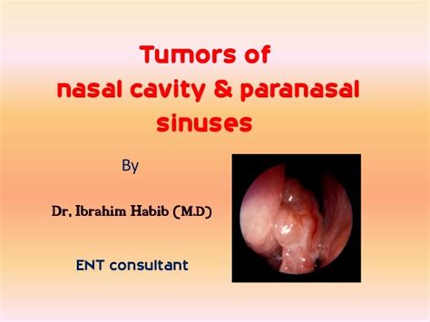 Cancerous Nasal Cancer