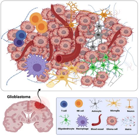 Main Cellular Content And Extracellular Matrix Of GBM Microenvironment