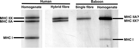 Separation Of The Myosin Heavy Chain MHC Isoforms Of Human And Baboon