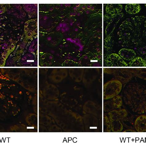 Immunofluorescence for nephrin (purple) and podocin (yellow) in the... | Download Scientific Diagram