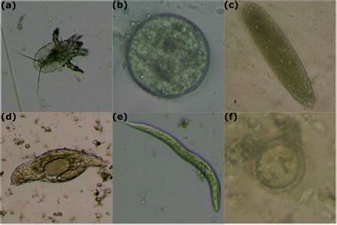 Parasites In Stool Microscope