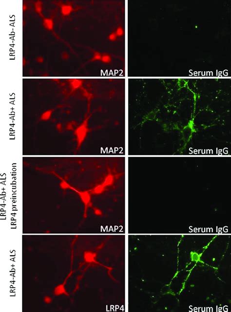 Representative images of cultured rat cortical neurons incubated with ... 