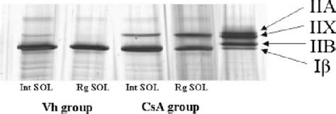 Separation Of MHC Isoforms By SDS Polyacrylamide Gel Electrophoresis