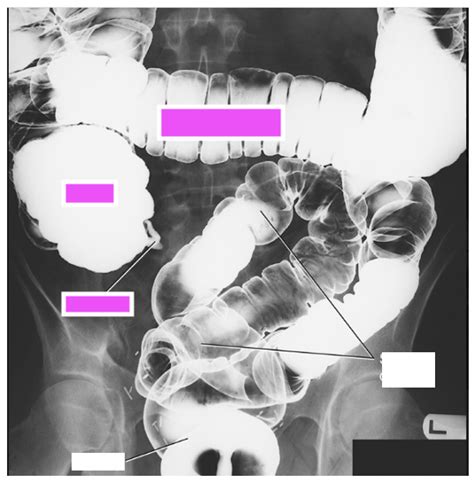 Fluoroscopy Diagram | Quizlet