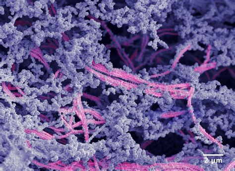 Cartilage Regeneration Breakthrough Ushers In a New Era of Joint Health