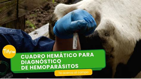 Cuadro Hem Tico Para Diagn Stico De Hemopar Sitos Tvagro Por Juan