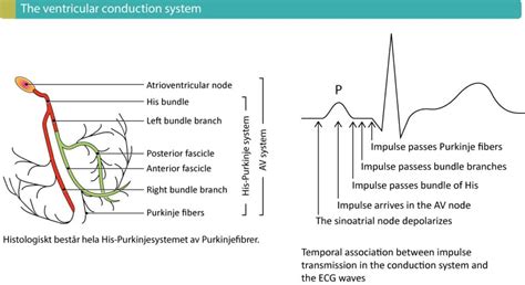 Overview of intraventricular conduction delay / defect – ECG learning