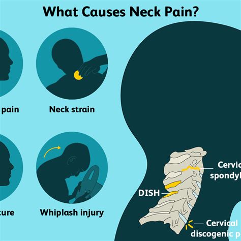 What Is The Best Treatment For Cervical Pain? - Whatnews2day.com