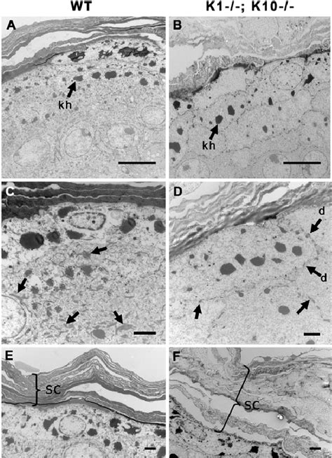 Ultrastructural Analysis Of The Epidermis Ad Tem Analysis Of