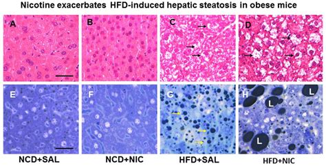 Representative Hande Stained Liver Sections From Mice Fed With Normal Download Scientific