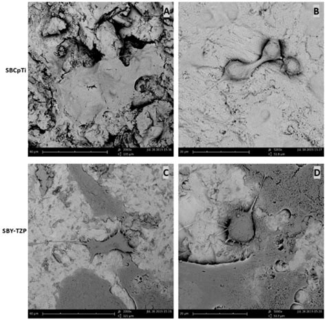 Sem Micrographs Of Cell Morphology On Sbcpti And Sby Tzp Surfaces Cell