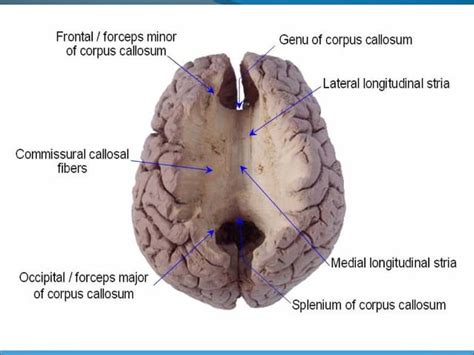 Anatomy of the Cerebrum