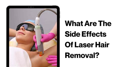 Laser hair removal side effects: Is it safe, is it painful, and more