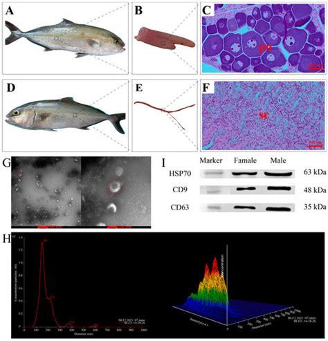 Ijms Free Full Text Sex Inclined Piwi Interacting Rnas In Serum